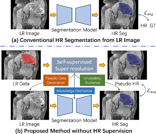 Figure 1 for REHRSeg: Unleashing the Power of Self-Supervised Super-Resolution for Resource-Efficient 3D MRI Segmentation