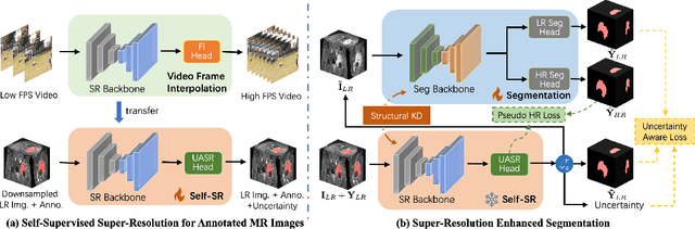 Figure 3 for REHRSeg: Unleashing the Power of Self-Supervised Super-Resolution for Resource-Efficient 3D MRI Segmentation