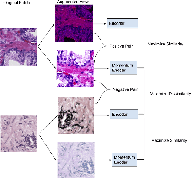 Figure 3 for Context-Aware Self-Supervised Learning of Whole Slide Images