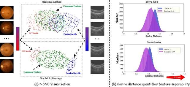 Figure 1 for Robust Multimodal Learning for Ophthalmic Disease Grading via Disentangled Representation