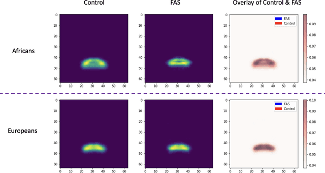 Figure 2 for OXSeg: Multidimensional attention UNet-based lip segmentation using semi-supervised lip contours