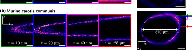 Figure 3 for Active Axial Motion Compensation in Multiphoton-Excited Fluorescence Microscopy