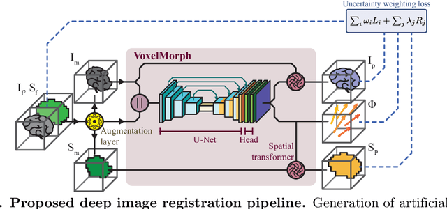 Figure 1 for Train smarter, not harder: learning deep abdominal CT registration on scarce data