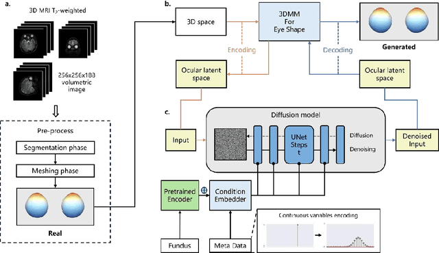Figure 2 for Fundus2Globe: Generative AI-Driven 3D Digital Twins for Personalized Myopia Management
