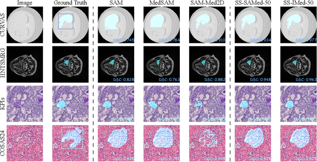 Figure 4 for SAM-UNet:Enhancing Zero-Shot Segmentation of SAM for Universal Medical Images