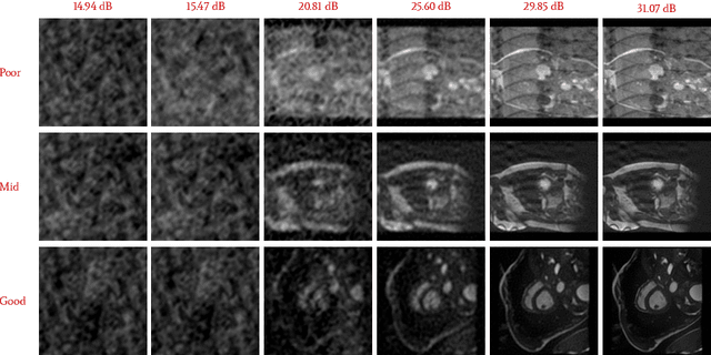 Figure 4 for Beyond Pixels: Medical Image Quality Assessment with Implicit Neural Representations