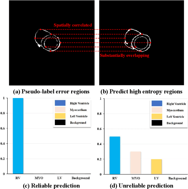 Figure 1 for Bidirectional Uncertainty-Aware Region Learning for Semi-Supervised Medical Image Segmentation