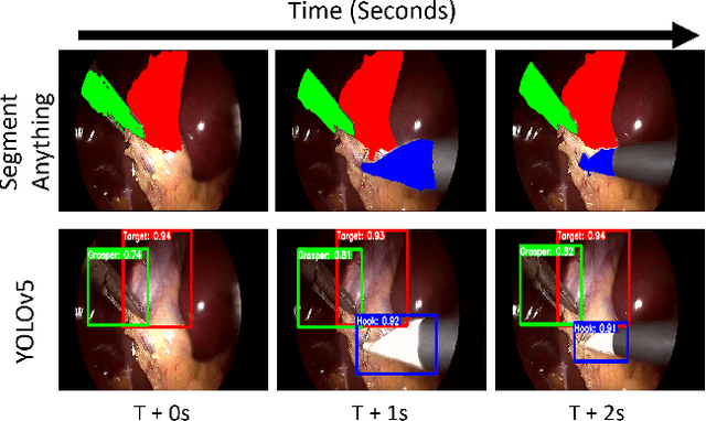 Figure 1 for Adaptive Graph Learning from Spatial Information for Surgical Workflow Anticipation