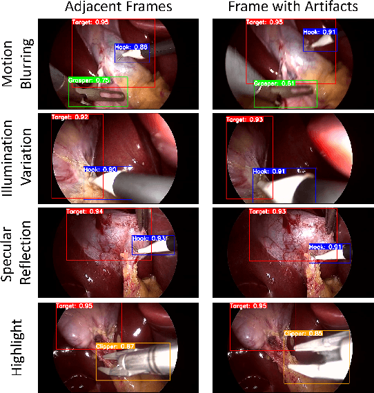 Figure 2 for Adaptive Graph Learning from Spatial Information for Surgical Workflow Anticipation