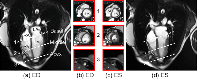 Figure 1 for Continuous Spatio-Temporal Memory Networks for 4D Cardiac Cine MRI Segmentation