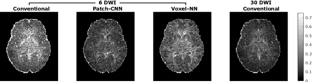 Figure 1 for Patch-CNN: Training data-efficient deep learning for high-fidelity diffusion tensor estimation from minimal diffusion protocols