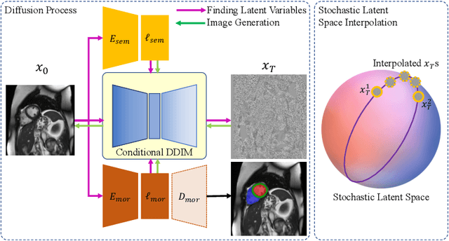 Figure 3 for DMCVR: Morphology-Guided Diffusion Model for 3D Cardiac Volume Reconstruction
