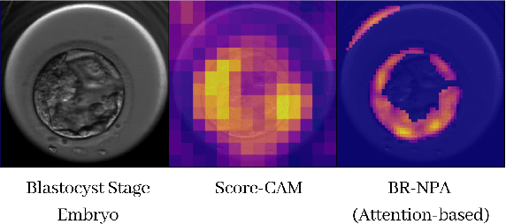 Figure 1 for Exploring the Role of Explainability in AI-Assisted Embryo Selection