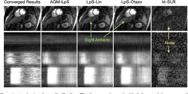 Figure 3 for Few Shot Alternating GD and Minimization for Generalizable Real-Time MRI