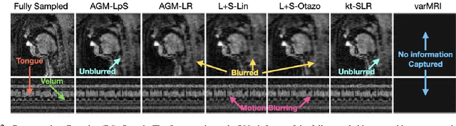 Figure 2 for Few Shot Alternating GD and Minimization for Generalizable Real-Time MRI