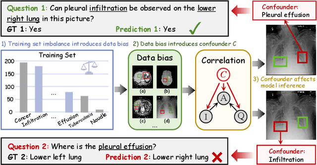 Figure 1 for Structure Causal Models and LLMs Integration in Medical Visual Question Answering