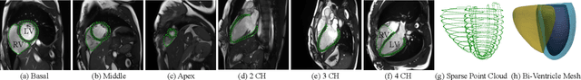 Figure 1 for Neural Deformable Models for 3D Bi-Ventricular Heart Shape Reconstruction and Modeling from 2D Sparse Cardiac Magnetic Resonance Imaging