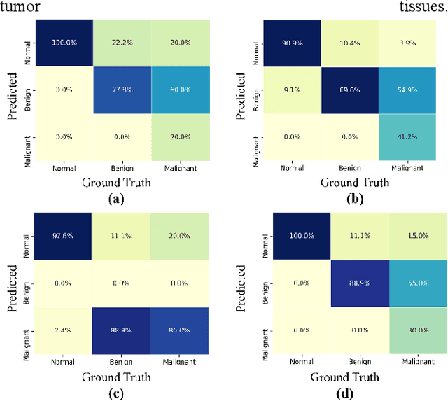 Figure 3 for Ensemble CNNs for Breast Tumor Classification