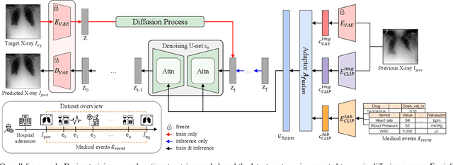 Figure 1 for Towards Predicting Temporal Changes in a Patient's Chest X-ray Images based on Electronic Health Records