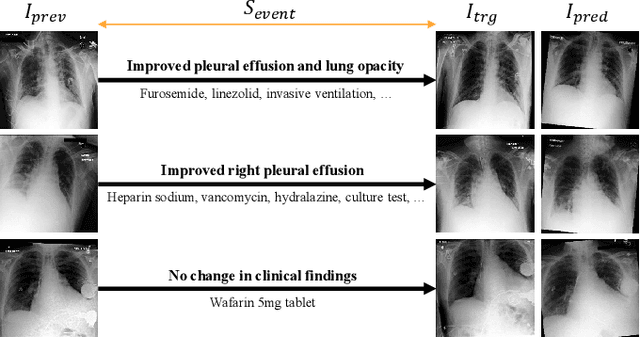 Figure 2 for Towards Predicting Temporal Changes in a Patient's Chest X-ray Images based on Electronic Health Records