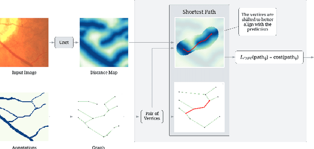 Figure 1 for CAPE: Connectivity-Aware Path Enforcement Loss for Curvilinear Structure Delineation