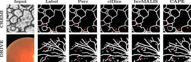 Figure 4 for CAPE: Connectivity-Aware Path Enforcement Loss for Curvilinear Structure Delineation