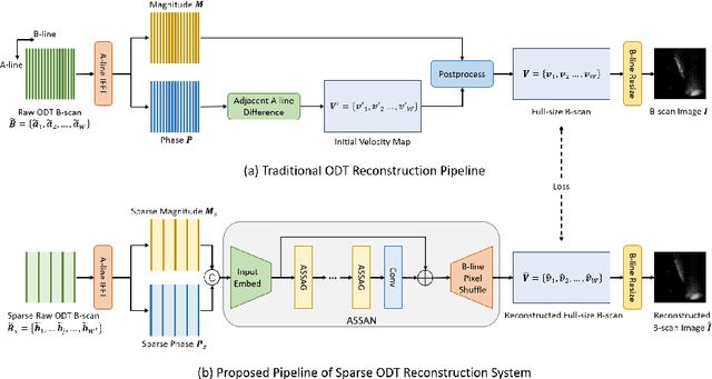 Figure 1 for Sparse Reconstruction of Optical Doppler Tomography Based on State Space Model