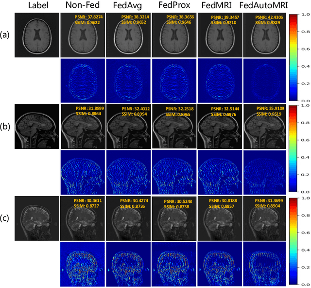 Figure 3 for FedAutoMRI: Federated Neural Architecture Search for MR Image Reconstruction