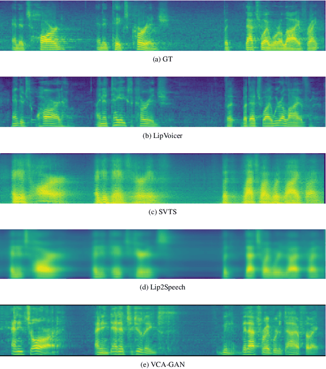 Figure 4 for LipVoicer: Generating Speech from Silent Videos Guided by Lip Reading
