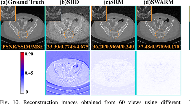 Figure 2 for Physics-informed DeepCT: Sinogram Wavelet Decomposition Meets Masked Diffusion