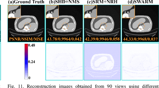 Figure 3 for Physics-informed DeepCT: Sinogram Wavelet Decomposition Meets Masked Diffusion