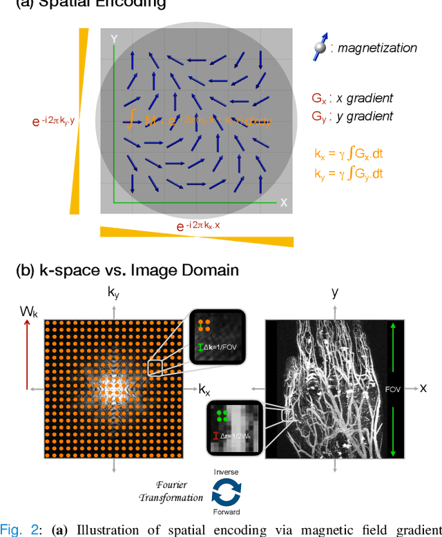 Figure 2 for A Tutorial on MRI Reconstruction: From Modern Methods to Clinical Implications