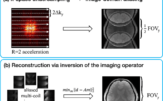 Figure 3 for A Tutorial on MRI Reconstruction: From Modern Methods to Clinical Implications