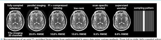 Figure 4 for A Tutorial on MRI Reconstruction: From Modern Methods to Clinical Implications