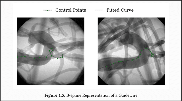 Figure 4 for Towards Autonomous Navigation in Endovascular Interventions