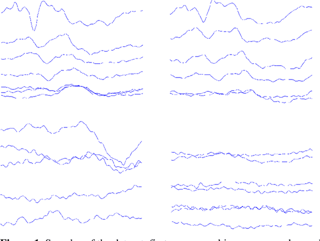 Figure 2 for Multi-Transfer Learning Techniques for Detecting Auditory Brainstem Response