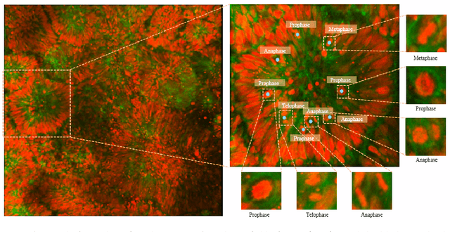 Figure 1 for BOrg: A Brain Organoid-Based Mitosis Dataset for Automatic Analysis of Brain Diseases