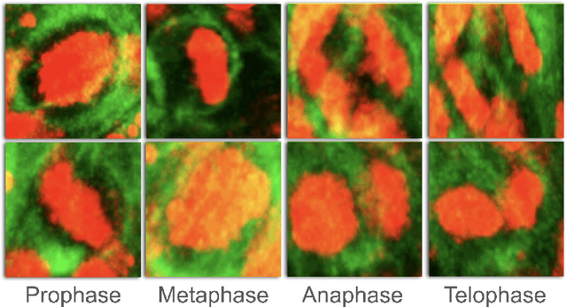 Figure 3 for BOrg: A Brain Organoid-Based Mitosis Dataset for Automatic Analysis of Brain Diseases