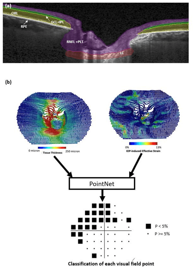 Figure 1 for Introducing the Biomechanics-Function Relationship in Glaucoma: Improved Visual Field Loss Predictions from intraocular pressure-induced Neural Tissue Strains