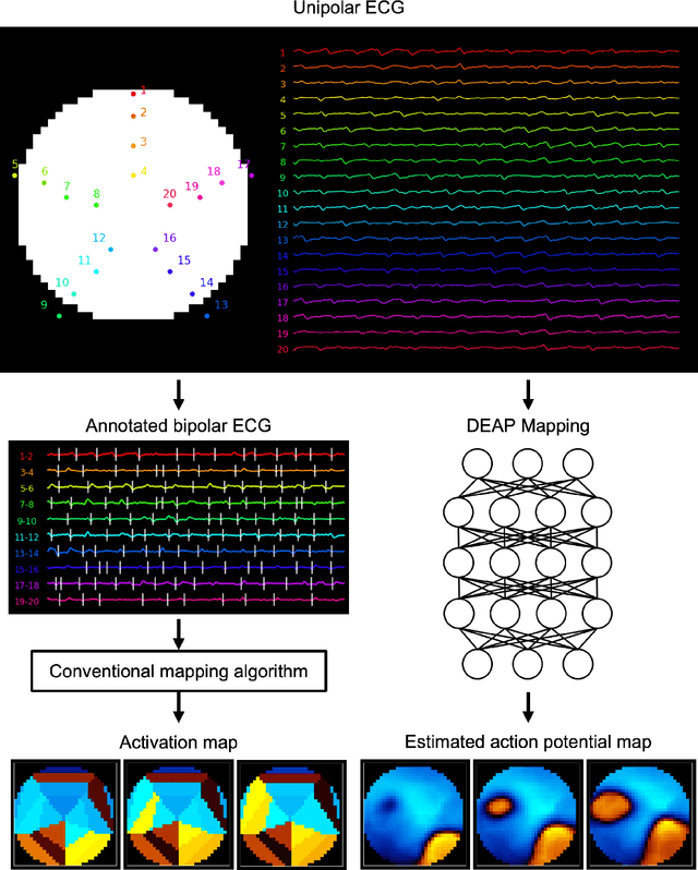 Figure 1 for Deep-learning-based electrode action potential mapping (DEAP Mapping) from annotation-free unipolar electrogram