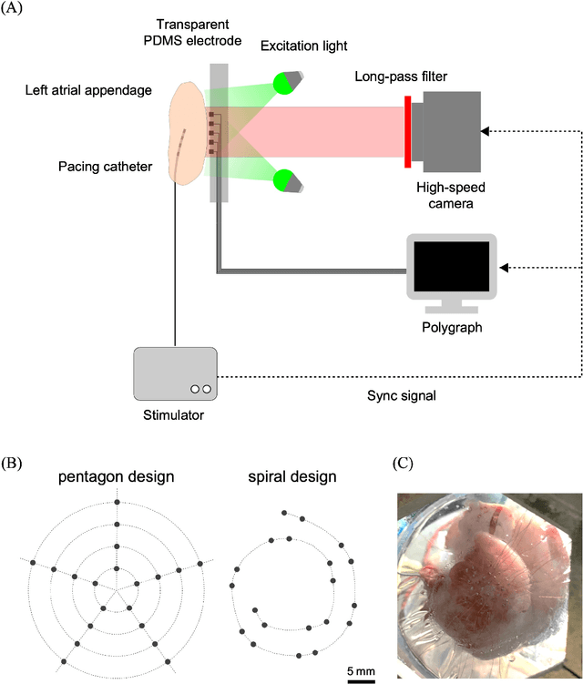 Figure 2 for Deep-learning-based electrode action potential mapping (DEAP Mapping) from annotation-free unipolar electrogram