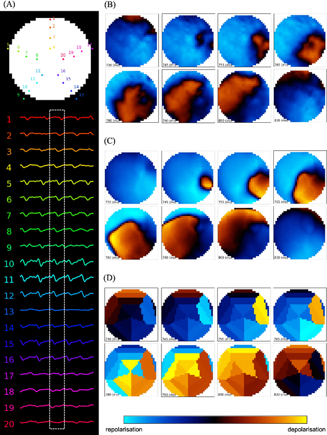 Figure 3 for Deep-learning-based electrode action potential mapping (DEAP Mapping) from annotation-free unipolar electrogram