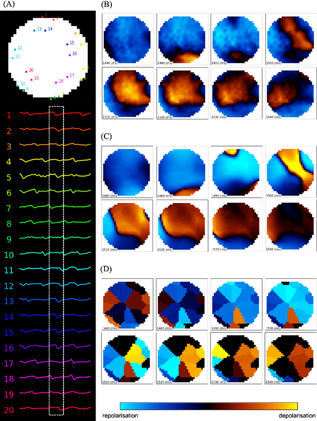 Figure 4 for Deep-learning-based electrode action potential mapping (DEAP Mapping) from annotation-free unipolar electrogram