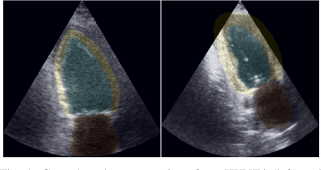 Figure 1 for Lightweight image segmentation for echocardiography