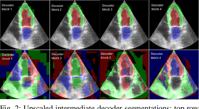 Figure 2 for Lightweight image segmentation for echocardiography