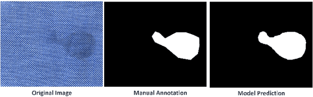 Figure 4 for Effective Transfer of Pretrained Large Visual Model for Fabric Defect Segmentation via Specifc Knowledge Injection