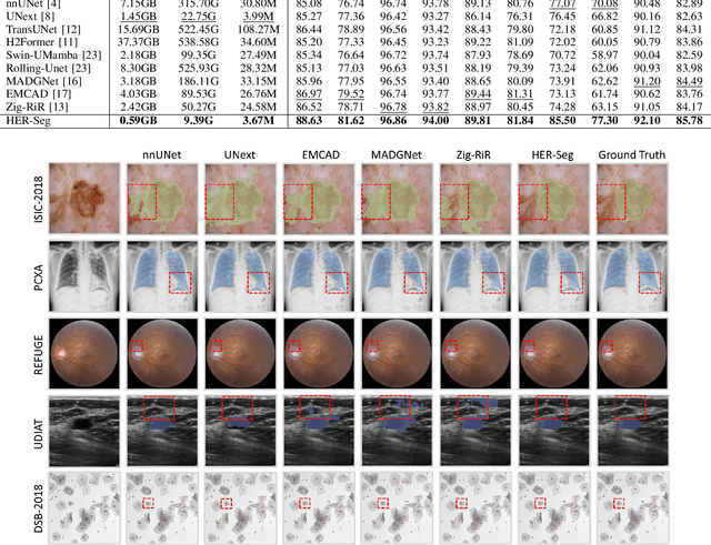Figure 4 for HRMedSeg: Unlocking High-resolution Medical Image segmentation via Memory-efficient Attention Modeling