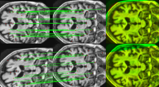 Figure 4 for Utilizing Radiomic Feature Analysis For Automated MRI Keypoint Detection: Enhancing Graph Applications
