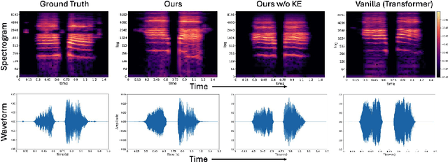 Figure 4 for Speech Audio Generation from dynamic MRI via a Knowledge Enhanced Conditional Variational Autoencoder