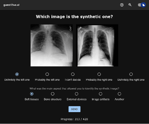 Figure 1 for Perceptual Evaluation of GANs and Diffusion Models for Generating X-rays